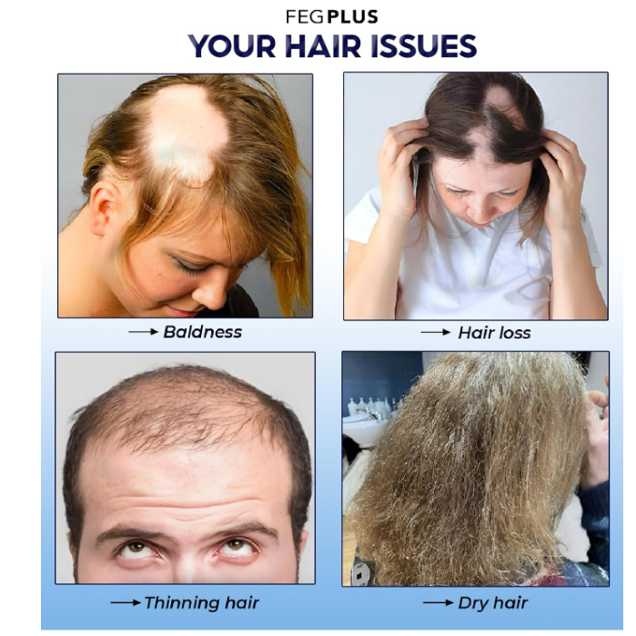 FEGPLUS Hair & Beard Growth Serum سيروم FEGPLUS لنمو الشعر واللحية