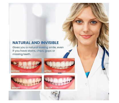 SnapOn Smile Dental Veneers for Men and Women